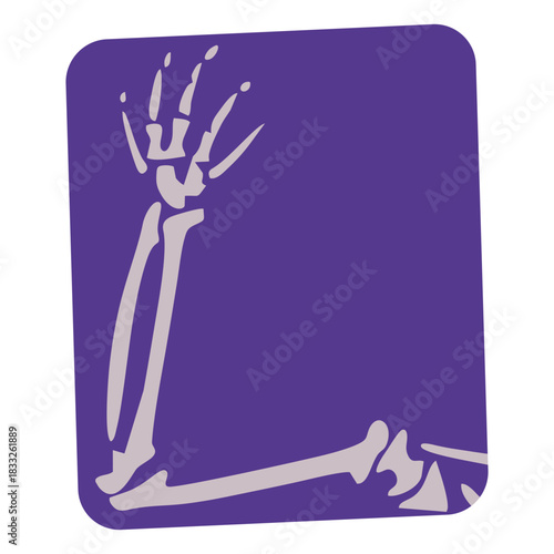 Broken arm flat xray