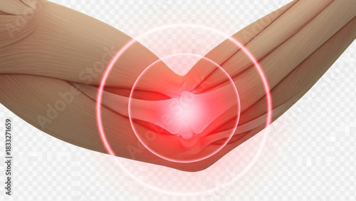 Illustration of an arm with a bright red circular glow indicating pain or inflammation around the elbow