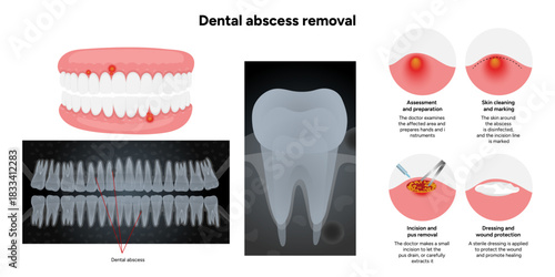 Hand-drawn dental infographic illustrating tooth anatomy with periodontal problems, including gums, roots, and supporting structures. 