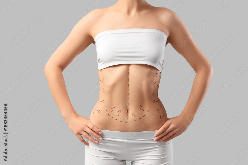 Obraz premium Young woman in underwear with marks on her belly against light background. Liposuction concept