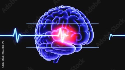 ECG Waveform Appearing Across Rotating Brain Model for Neuro-Cardiac Analysis