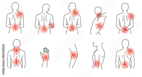Vector illustration showing various body pain locations, highlighting common areas affected by stress, injury, or underlying medical conditions in a minimalist style.