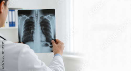 Doctor examining a patient's chest x-ray film for lung diagnosis in a modern medical clinic with copy space