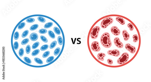 Simple vector illustration comparing a microscopic view of healthy, uniform blue cells versus abnormal, disorganized red cells for medical analysis.