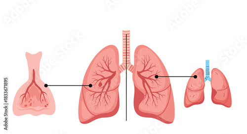 Medical illustrations of the human lungs showing anatomy, a detailed view of alveoli, and common pathologies or medical procedures.