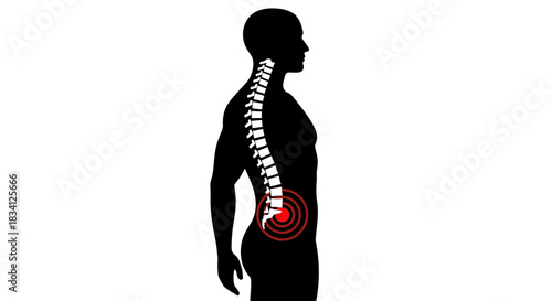 Back pain spine health medical illustration silhouette anatomy