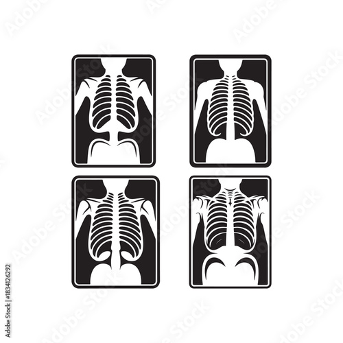 Black Color X-ray Board set Silhouette Vector Illustration, Solid White Background.