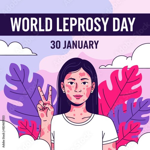 Illustration of a girl showing skin patches for World Leprosy Day awareness, promoting compassion, inclusion, and global support on January 30.
