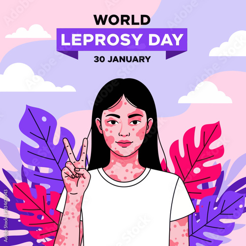 Illustration of a girl showing skin patches for World Leprosy Day awareness, promoting compassion, inclusion, and global support on January 30.