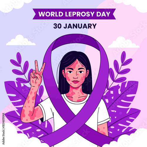 Illustration of a girl showing skin patches for World Leprosy Day awareness, promoting compassion, inclusion, and global support on January 30.