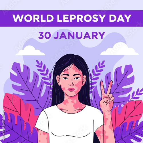 Illustration of a girl showing skin patches for World Leprosy Day awareness, promoting compassion, inclusion, and global support on January 30.