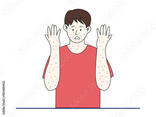 Unhealthy boy with red spots on body suffer from measles. Healthy problems vector illustration. Flat illustration.