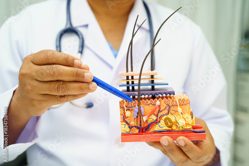 Hair transplant, Asian dermatologist doctor holding skin structure anatomy model for treatment in hospital.