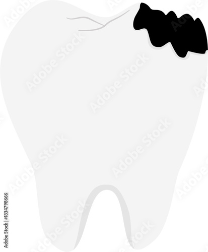 Tooth decay illustration – damaged graphic