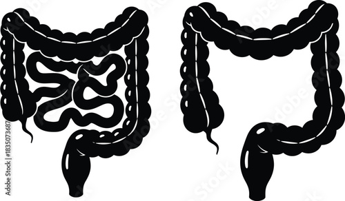 Human colon anatomy illustration healthy vs unhealthy bowel digestive system comparison