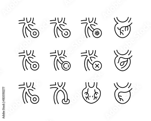 Cardiology medical line icons set showing anatomical heart structure, coronary arteries, stent insertion, bypass surgery, vessel blockage, and treatment success failure diagrams for health presentatio