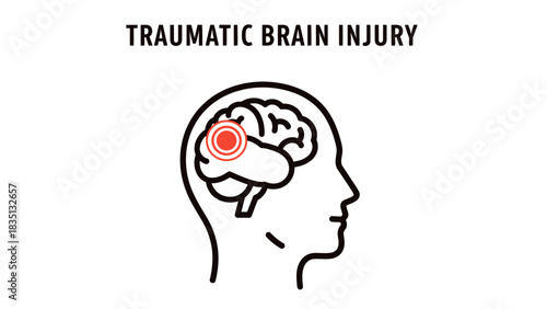 Traumatic Brain Injury (TBI) Vector Icon
