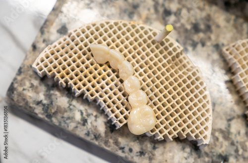 Obraz na plátně Ceramic dental crowns on refractory base in dental lab for prosthetics, orthodontics, oral restoration, implant solutions