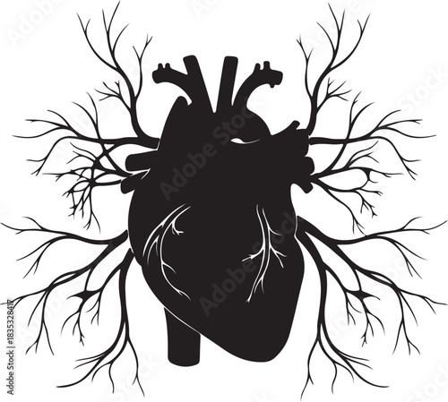 Myocardial infarction, black isolated silhouette
