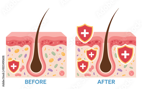 Hair Follicle Illustration Showing Before and After Treatment with Protective Shields Promoting Hair Health and Growth