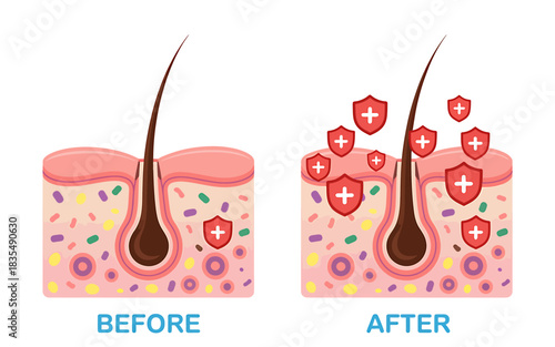 Hair Follicle Protection Before and After Treatment Promoting Hair Health and Stronger Hair Growth
