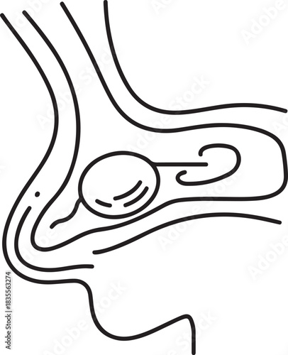 Sinus cyst drawn with lines. Benign sac-like formation in the cavity of the paranasal sinus. Medical vector illustration for different uses. one line Icon drawing