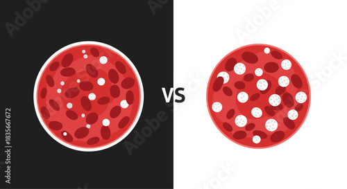 Medical illustration comparing healthy red blood cells on the left versus clotted or unhealthy cells on the right side.