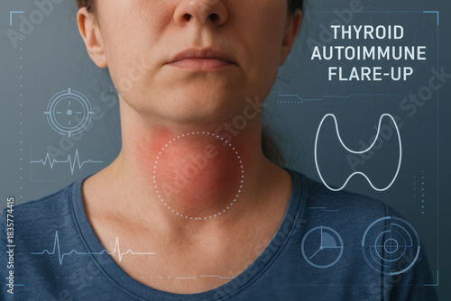 Thyroid autoimmune flare up showing swollen neck on concerned woman. Medical technology interface illustrates health diagnosis with virtual UI indicator
