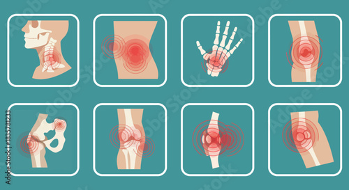 Detailed vector illustration displaying a set of human joints and bones, ideal for educational materials or medical presentations, showcasing anatomical structure and health.