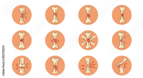 A comprehensive vector illustration set showcasing various types of human bone fractures and joint injuries, perfect for medical and educational purposes.