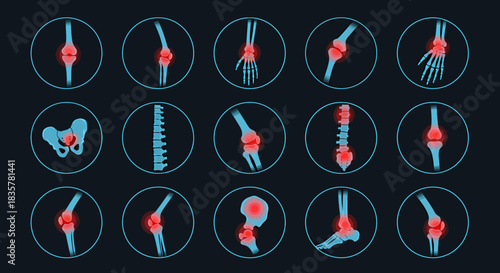 A comprehensive vector illustration set showcasing various human anatomical joints and bones, highlighted in red for medical diagnosis or educational content.