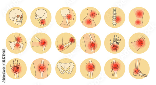 A detailed vector illustration showcases a set of human joints and bones, highlighting areas of pain and inflammation, ideal for medical or educational purposes.