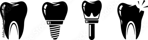 Dental implants and tooth anatomy illustrations