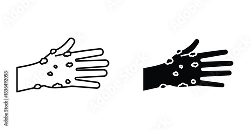 Rash hand icon. Line with editable stroke and flat for Web