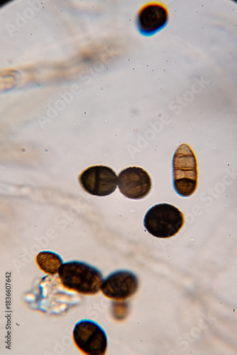 Dematiaceous Fungal Spores Exhibiting Transverse and Longitudinal Septation, Likely of the Genus Alterna