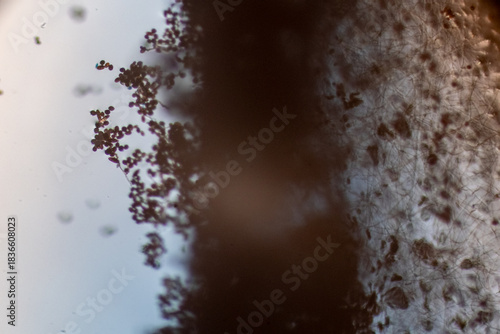 High-Power Photomicrograph Revealing Multicellular Dematiaceous Fungal Spores Exhibiting Transverse and Longitudinal Septa