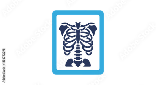 Medical X-ray image of a human rib cage and skeletal structure.