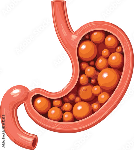 Human stomach internal view with gas or food bubbles, isolated on white background, detailed vector illustration for digestion, bloating, and gastrointestinal health.