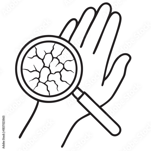 Dry skin on hand magnified by magnifying glass showing cracking and discomfort