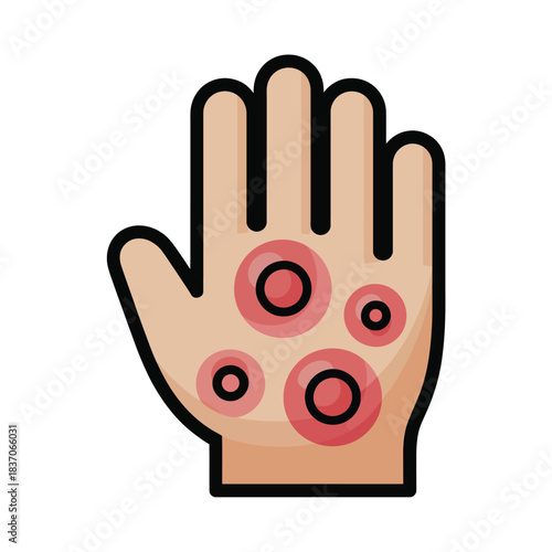 Hand with allergic reaction skin rash or eczema showing inflamed red bumps and circles dermatology issue vector illustration isolated graphic