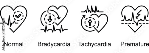 Heart Rate And Rhythm Disorders banner web icon vector illustration of Normal, Bradycardia, Tachycardia, Premature