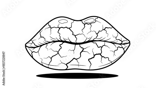 Cracked lips illustration, symbol of dehydration, dryness, and potential health issues