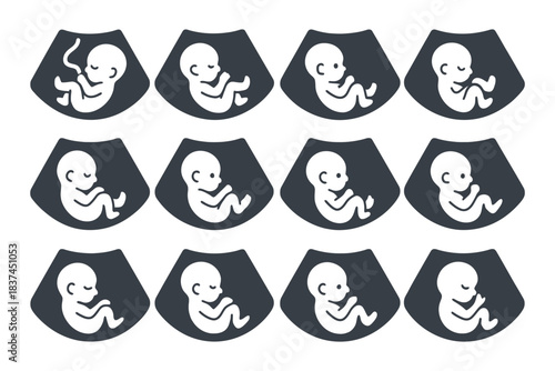 Embryo development stages: fetal growth illustrated in twelve silhouettes.