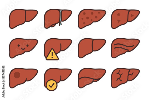 Vector illustration of diverse liver conditions with icons.