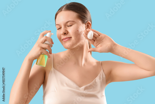 Teenage girl with acne prob...