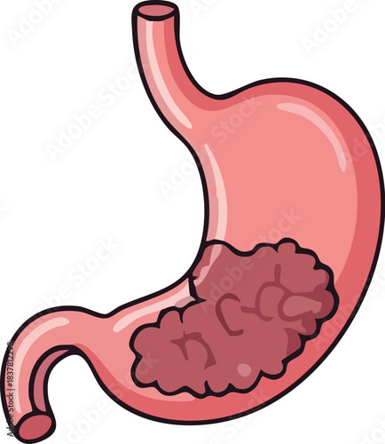 A pink cartoon illustration of the human stomach for medical and digestive design