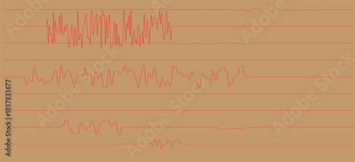 Heart health checkup cardiology medical examination with magnifying glass and ecg heartbeat graph tool. vector illustration.
