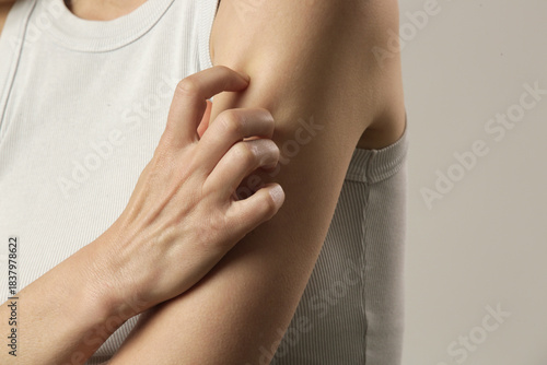 Billede på lærred Close up view of woman scratching her arm
