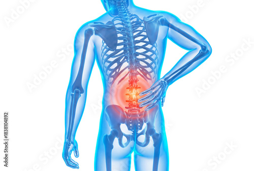 Medical illustration of lower back pain with highlighted spine on white or transparent background.