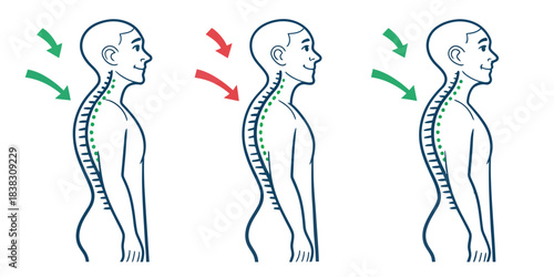 Good Posture vs Bad Posture Comparison drawn correction